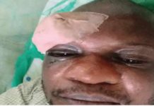 Irate residents stabbed IBEDC staff bottle in the eye for distributing utility bill