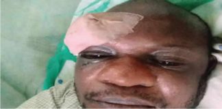 Irate residents stabbed IBEDC staff bottle in the eye for distributing utility bill