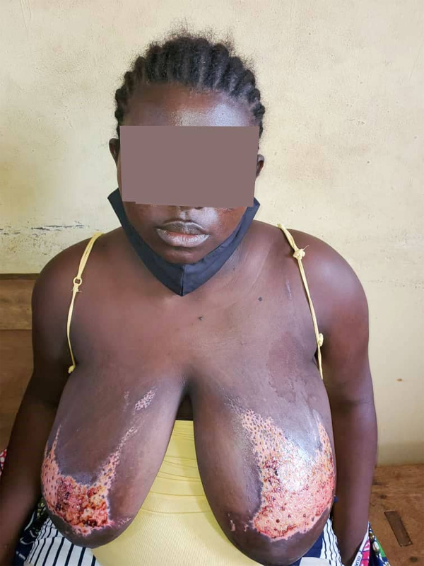 Police arrest Ghanaian for pouring hot water on lover