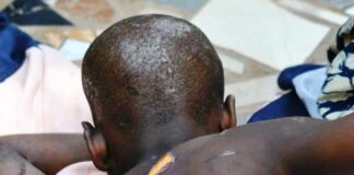 Police rescue 10-year-old boy from household grievous harm, battering in Enugu