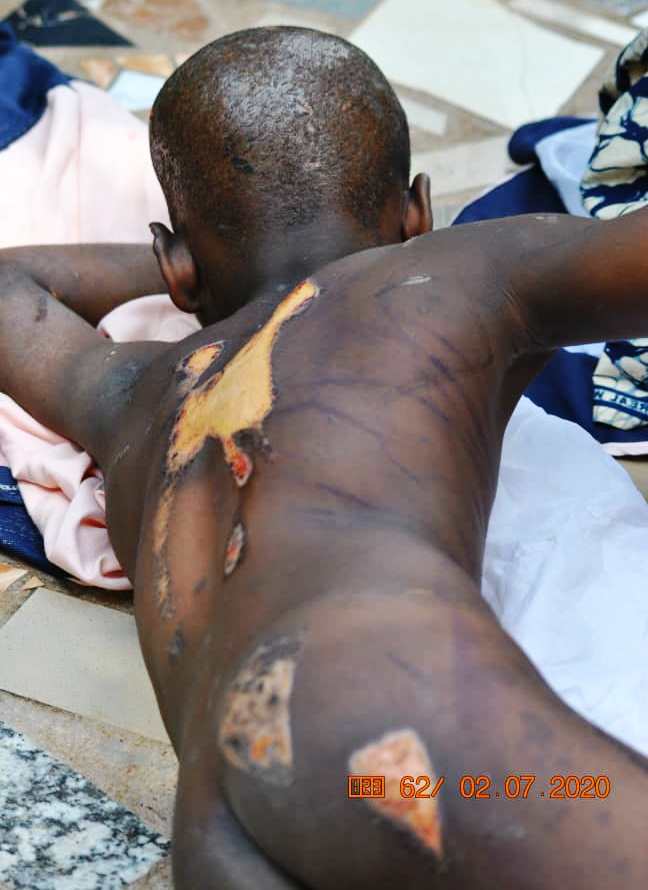 Police rescue 10-year-old boy from household grievous harm, battering in Enugu