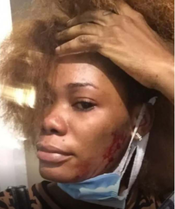 Ivorian Lady Who Tattooed Bobrisky Drags Him For Beating Her Up