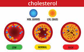 'Why Nigerians must cut down cholesterol intake'