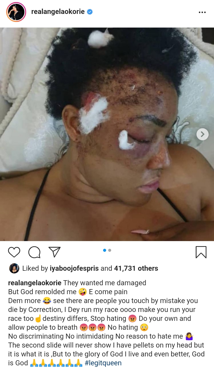 Pellets Still Coming Out Two Years After I Was Shot By Gunmen- Angela Okorie