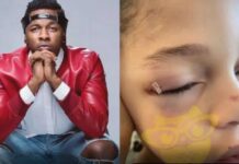 Singer Runtown's Son Suffers Eye Injury