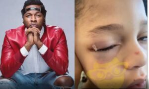 Singer Runtown's Son Suffers Eye Injury