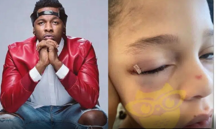 Singer Runtown's Son Suffers Eye Injury