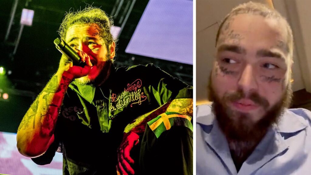 Post Malone Suffers Bruised Ribs After Falling Through Hole Performing On Stage