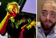 Post Malone Suffers Bruised Ribs After Falling Through A Hole On Stage While Performing