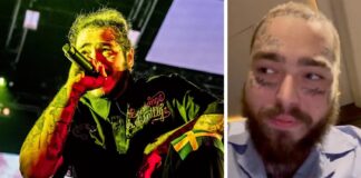 Post Malone Suffers Bruised Ribs After Falling Through A Hole On Stage While Performing