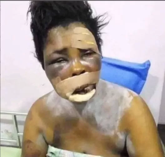 How My Son Tried To Remove My Eyes For Money Ritual – Delta Woman