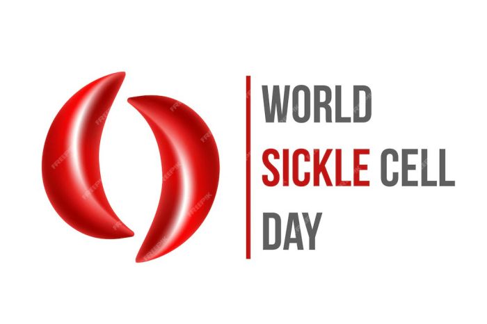 #WorldSickleCellDay: All You Need To Know About Sickle Cell