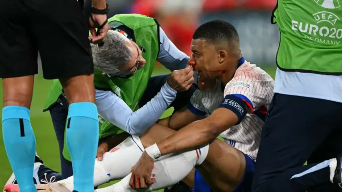 Didier Confirms Mbappe Will Undergo Surgery On Broken Nose
