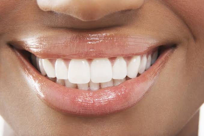 7 Tips On How To Strengthen Your Gums And Teeth