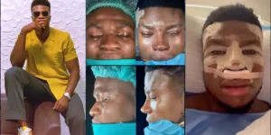 “My Appearance Cost Me Gigs” – Zic Saloma Speaks On Nose Surgery Journey